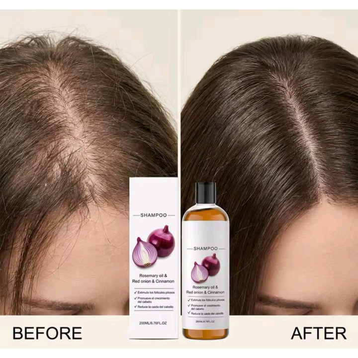 Shampoing à la rosemary et à l'oignon rouge anti-chute 200ml